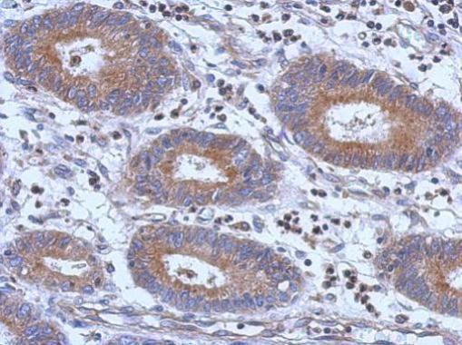 PARP11 Antibody in Immunohistochemistry (Paraffin) (IHC (P))