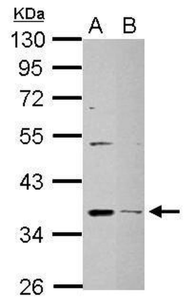 DHRS9 Antibody in Western Blot (WB)