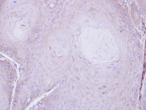 C16orf62 Antibody in Immunohistochemistry (Paraffin) (IHC (P))
