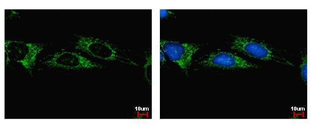 ALDH1B1 Antibody in Immunocytochemistry (ICC/IF)
