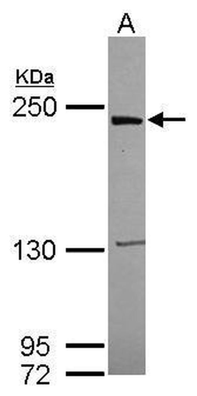 LRRK1 Antibody in Western Blot (WB)