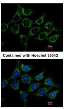 AGK Antibody in Immunocytochemistry (ICC/IF)