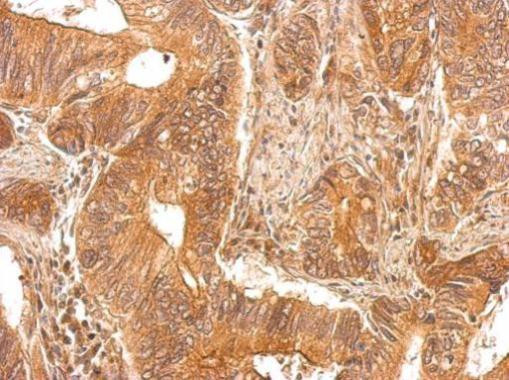 PAPSS1 Antibody in Immunohistochemistry (Paraffin) (IHC (P))