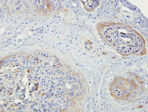 NEK3 Antibody in Immunohistochemistry (Paraffin) (IHC (P))