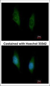 MEK6 Antibody in Immunocytochemistry (ICC/IF)
