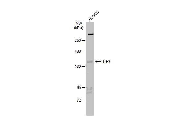 TEK Antibody in Western Blot (WB)