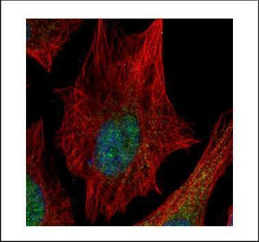 SPHK1 Antibody in Immunocytochemistry (ICC/IF)
