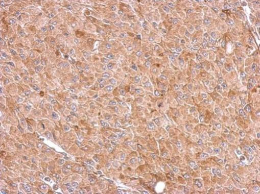 RIOK3 Antibody in Immunohistochemistry (Paraffin) (IHC (P))