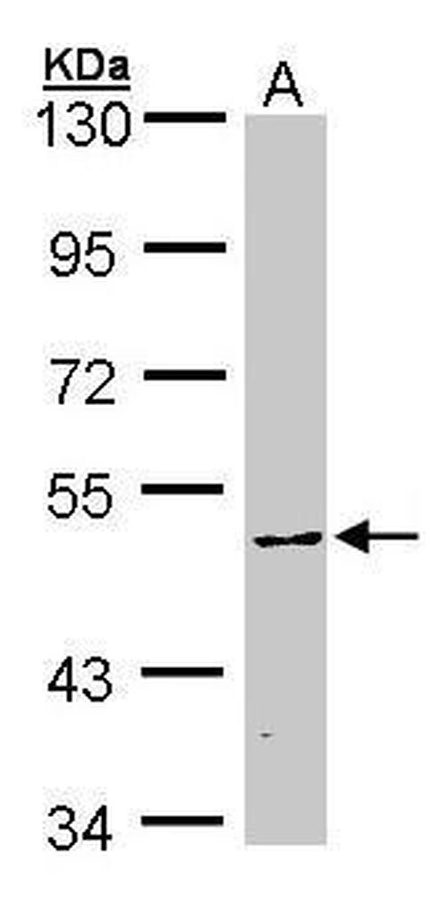 CaMKIV Antibody in Western Blot (WB)