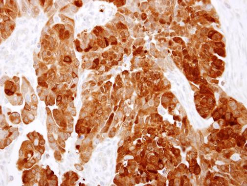 CCDC6 Antibody in Immunohistochemistry (Paraffin) (IHC (P))
