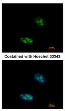 EXOSC10 Antibody in Immunocytochemistry (ICC/IF)