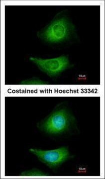 MEK3 Antibody in Immunocytochemistry (ICC/IF)