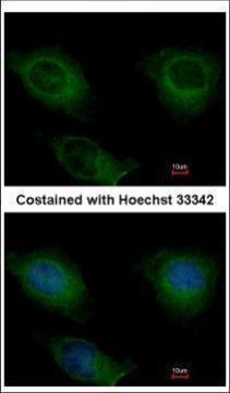 CKMT2 Antibody in Immunocytochemistry (ICC/IF)