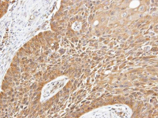 STK32B Antibody in Immunohistochemistry (Paraffin) (IHC (P))