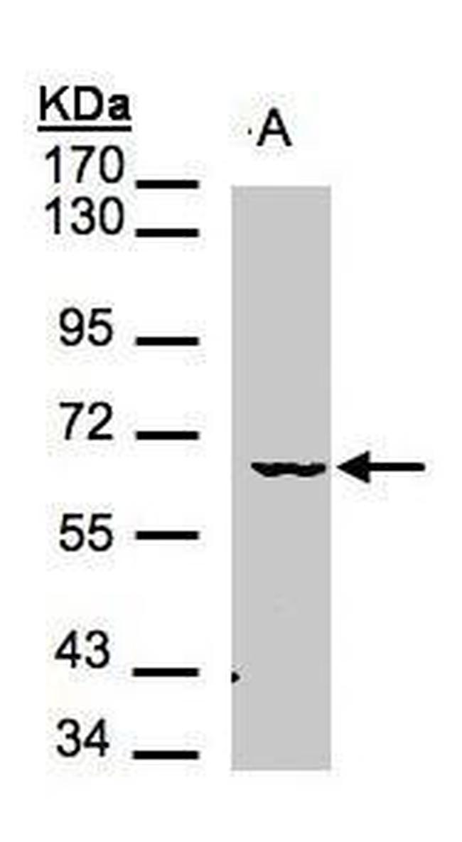 MAK Antibody in Western Blot (WB)