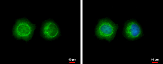 LYK5 Antibody in Immunocytochemistry (ICC/IF)