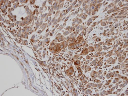 PFTK2 Antibody in Immunohistochemistry (Paraffin) (IHC (P))