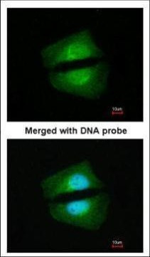 TAB1 Antibody in Immunocytochemistry (ICC/IF)