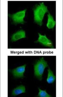 RIP3 Antibody in Immunocytochemistry (ICC/IF)