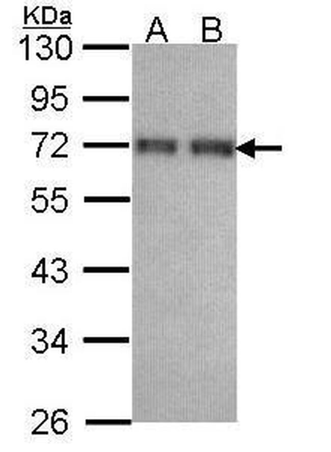 CCDC6 Antibody in Western Blot (WB)