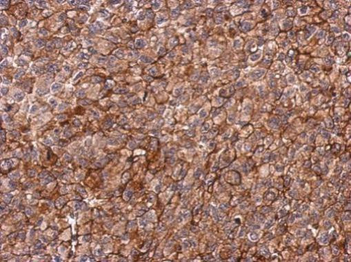 PIP5KL1 Antibody in Immunohistochemistry (Paraffin) (IHC (P))