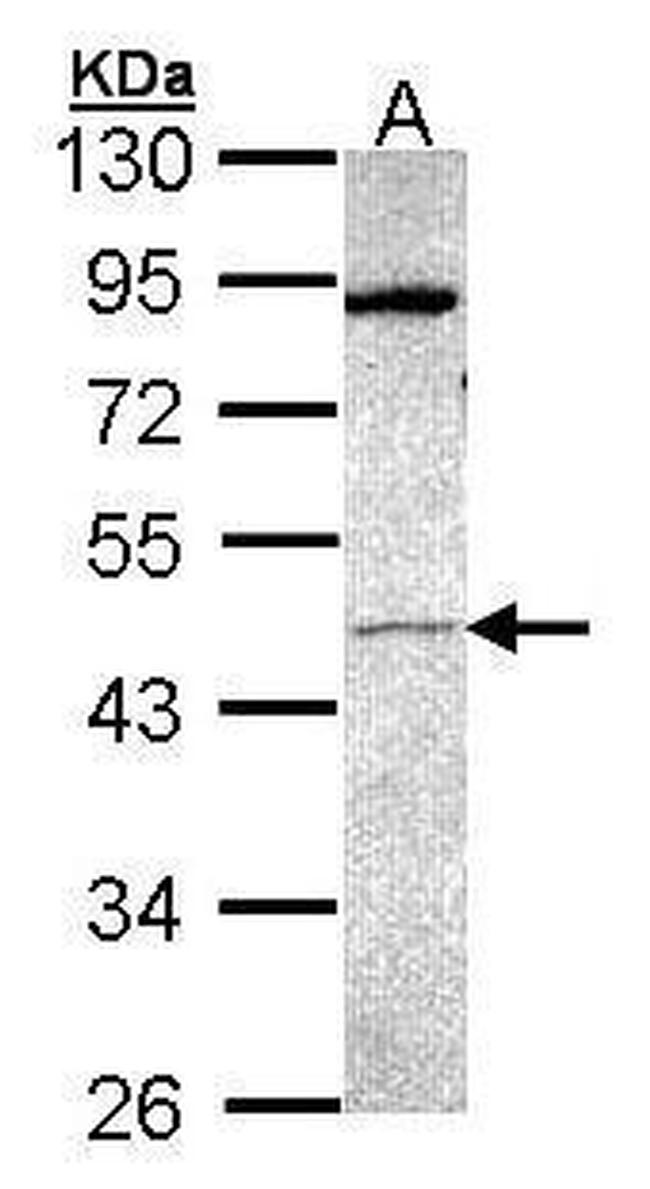 PRAK Antibody in Western Blot (WB)