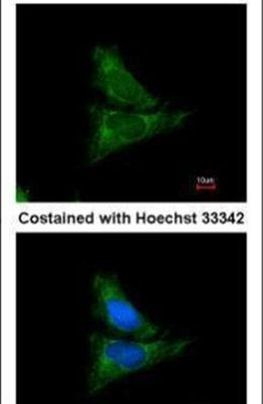 FGR Antibody in Immunocytochemistry (ICC/IF)