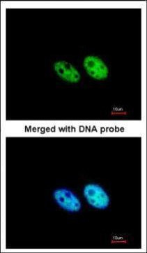 SART3 Antibody in Immunocytochemistry (ICC/IF)