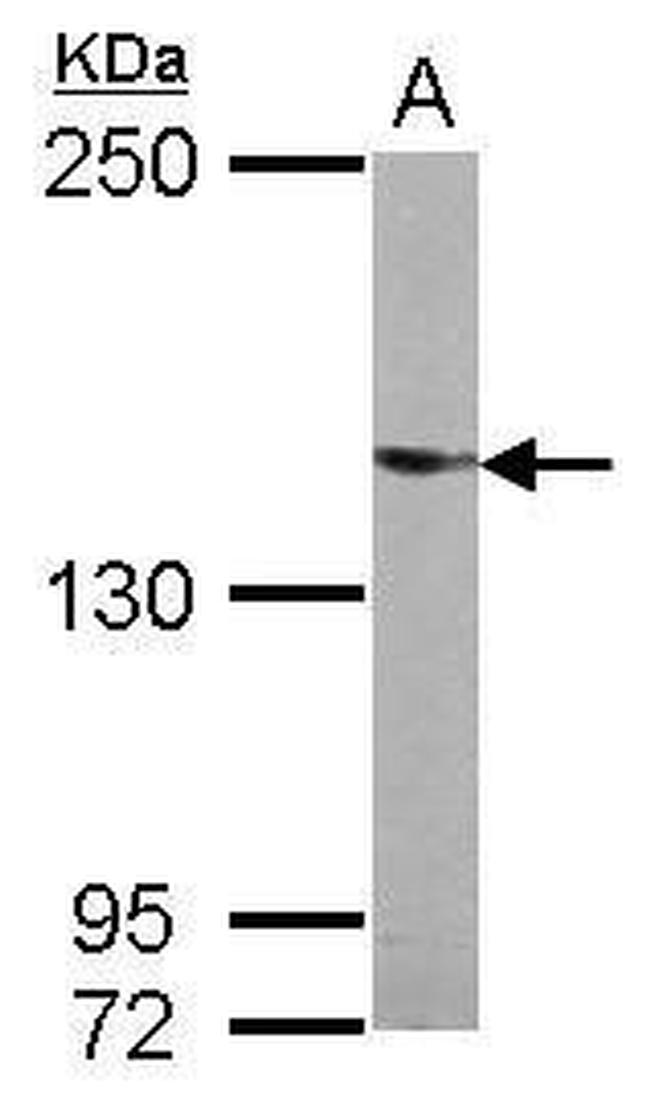 UPF2 Antibody in Western Blot (WB)