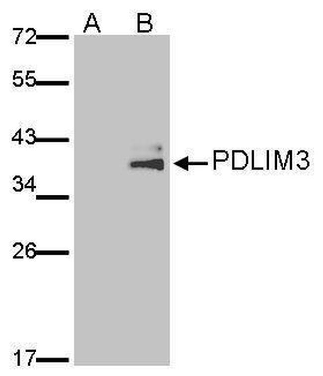 PDLIM3 Antibody in Western Blot (WB)