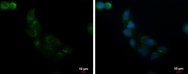 ALS2CR2 Antibody in Immunocytochemistry (ICC/IF)