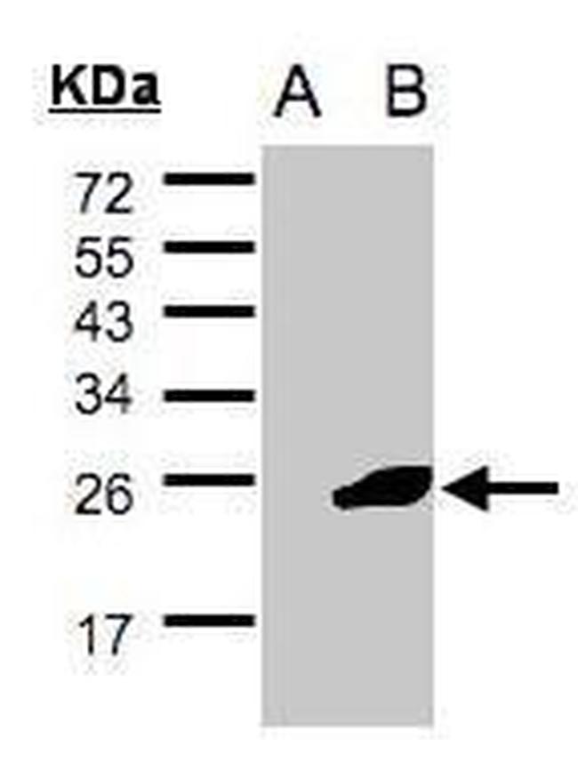 NCE2 Antibody in Western Blot (WB)