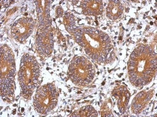 FHL2 Antibody in Immunohistochemistry (Paraffin) (IHC (P))