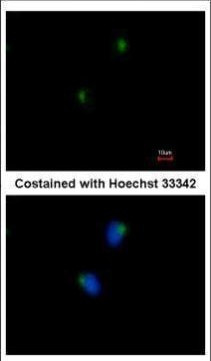 SLITRK1 Antibody in Immunocytochemistry (ICC/IF)