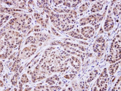 MVK Antibody in Immunohistochemistry (Paraffin) (IHC (P))
