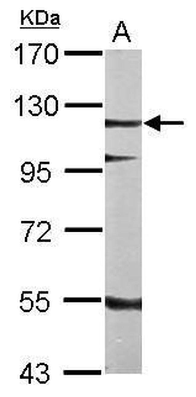 SRPK2 Antibody in Western Blot (WB)
