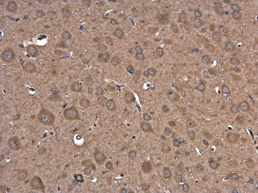 PIK3R5 Antibody in Immunohistochemistry (Paraffin) (IHC (P))