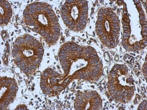 TIE1 Antibody in Immunohistochemistry (Paraffin) (IHC (P))