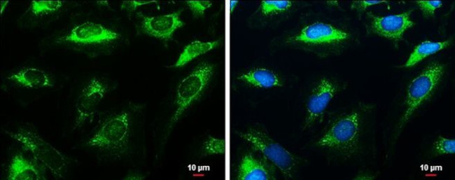 HK3 Antibody in Immunocytochemistry (ICC/IF)