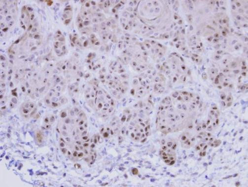EXOSC10 Antibody in Immunohistochemistry (Paraffin) (IHC (P))