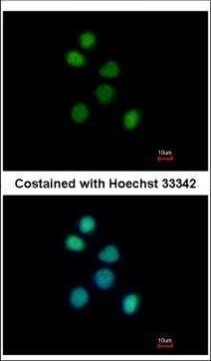 FES Antibody in Immunocytochemistry (ICC/IF)
