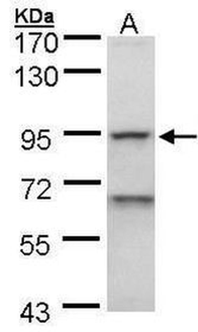 EEF2K Antibody in Western Blot (WB)