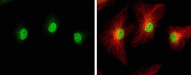 IP6K2 Antibody in Immunocytochemistry (ICC/IF)