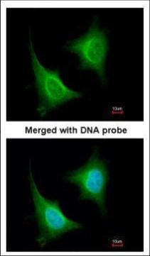TAB1 Antibody in Immunocytochemistry (ICC/IF)