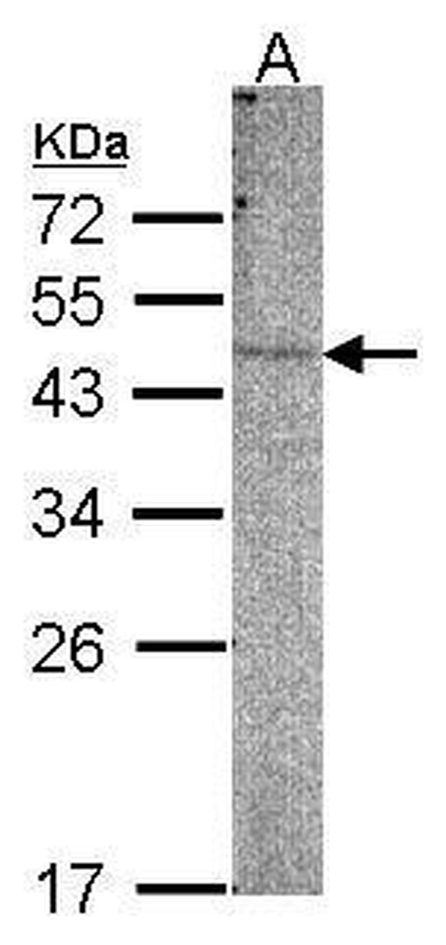 PI4K2B Antibody in Western Blot (WB)