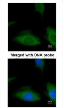 CSK Antibody in Immunocytochemistry (ICC/IF)