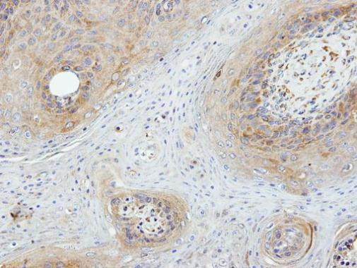 ASK1 Antibody in Immunohistochemistry (Paraffin) (IHC (P))