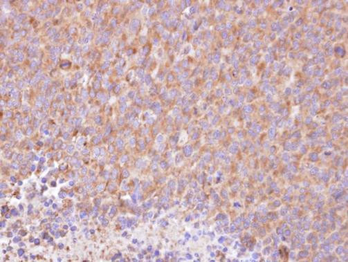 RIPK5 Antibody in Immunohistochemistry (Paraffin) (IHC (P))