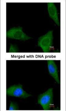 CoA Synthase Antibody in Immunocytochemistry (ICC/IF)