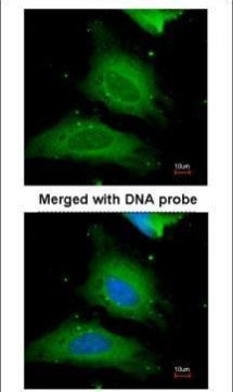 UGP2 Antibody in Immunocytochemistry (ICC/IF)